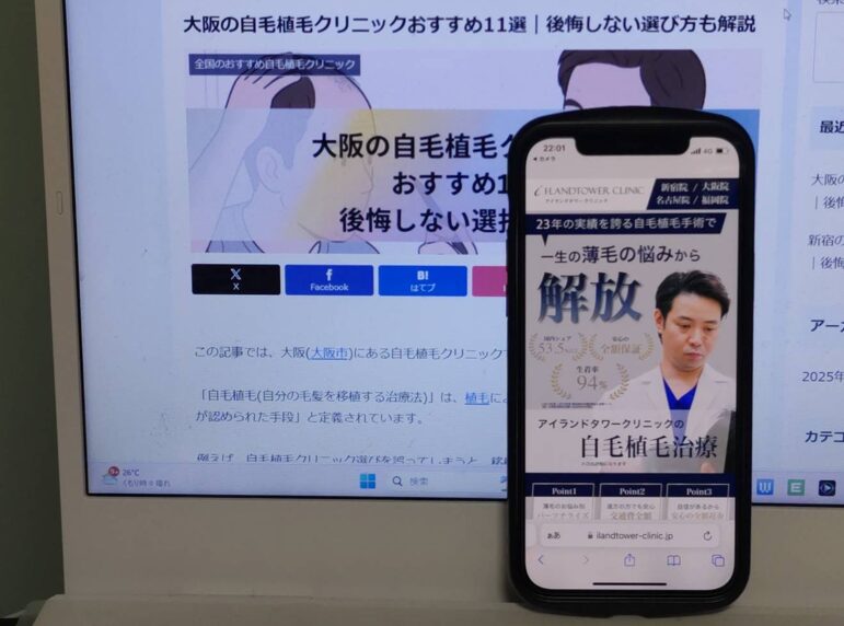 大阪の自毛植毛クリニックおすすめ11選｜後悔しない選び方も解説