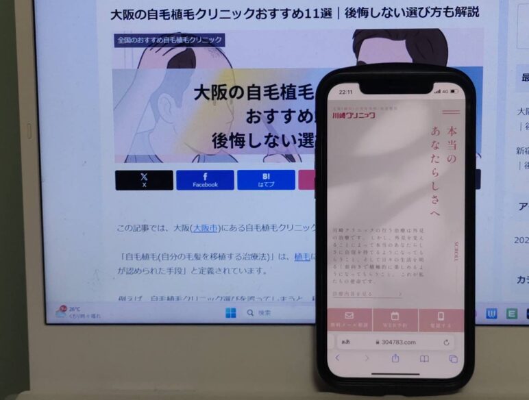 大阪の自毛植毛クリニックおすすめ11選｜後悔しない選び方も解説