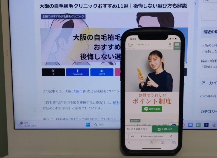 大阪の自毛植毛クリニックおすすめ11選｜後悔しない選び方も解説