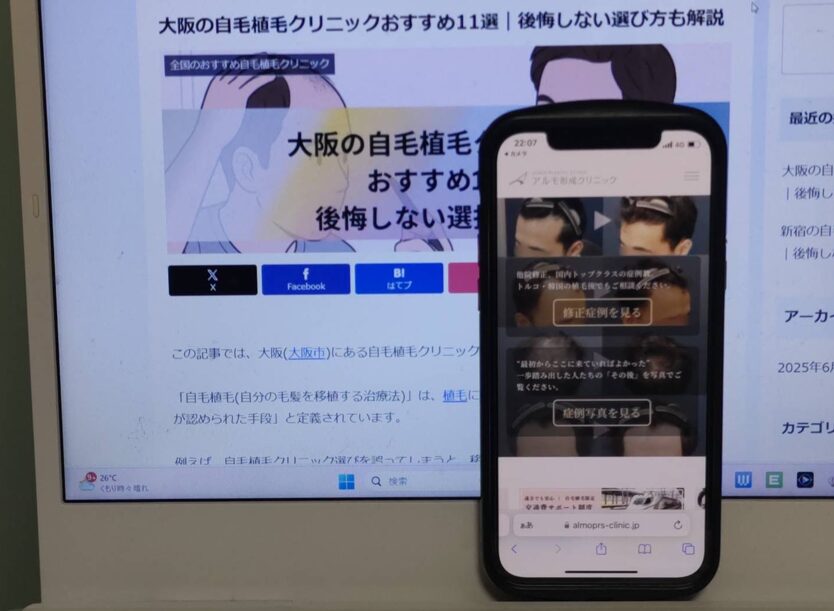 大阪の自毛植毛クリニックおすすめ11選｜後悔しない選び方も解説