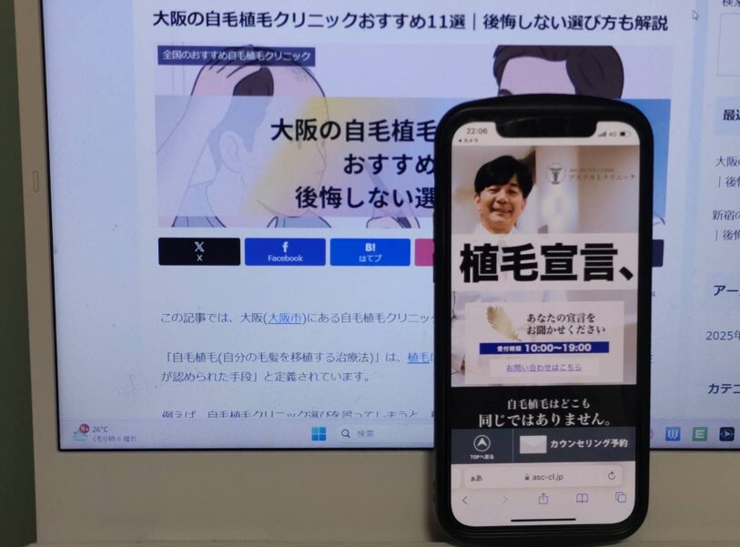 大阪の自毛植毛クリニックおすすめ11選｜後悔しない選び方も解説