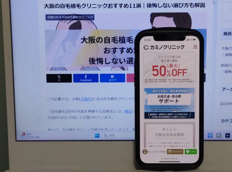 大阪の自毛植毛クリニックおすすめ11選｜後悔しない選び方も解説
