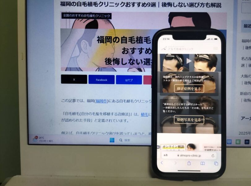 福岡の自毛植毛クリニックおすすめ9選｜後悔しない選び方も解説