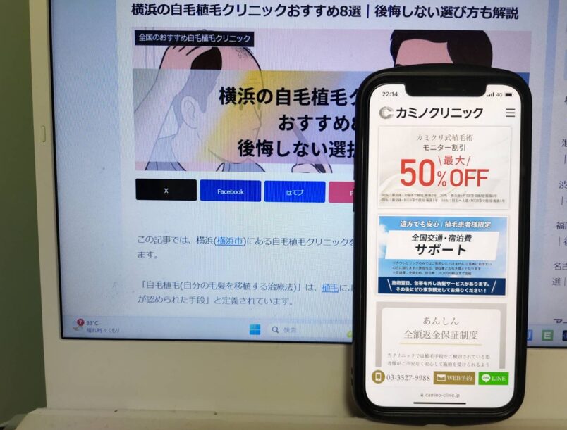 池袋の自毛植毛クリニックおすすめ9選｜後悔しない選び方も解説