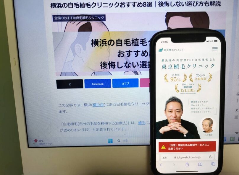 横浜の自毛植毛クリニックおすすめ8選｜後悔しない選び方も解説