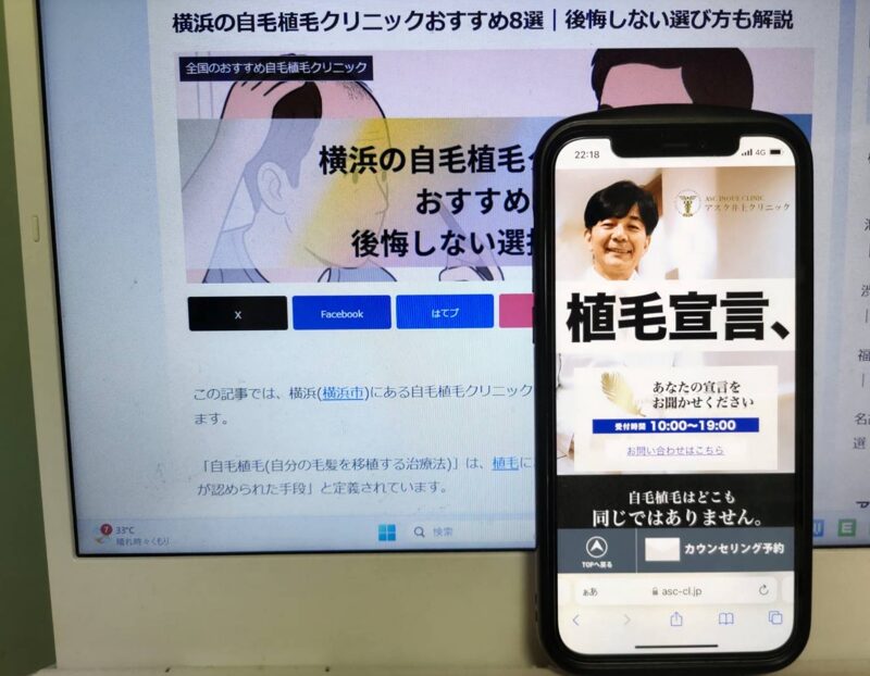 横浜の自毛植毛クリニックおすすめ8選｜後悔しない選び方も解説