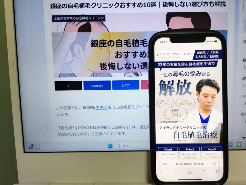 銀座の自毛植毛クリニックおすすめ10選｜後悔しない選び方も解説