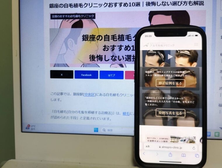 銀座の自毛植毛クリニックおすすめ10選｜後悔しない選び方も解説