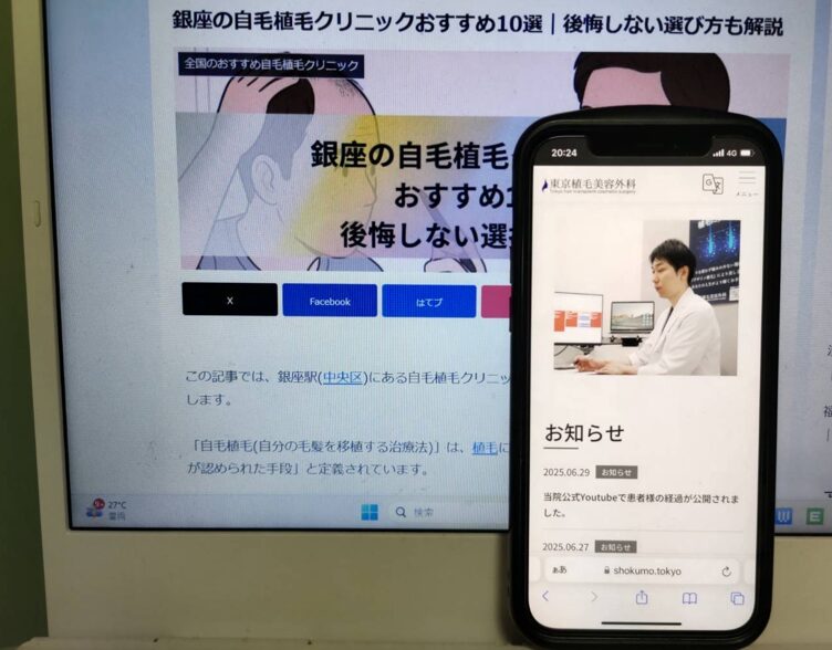 銀座の自毛植毛クリニックおすすめ10選｜後悔しない選び方も解説