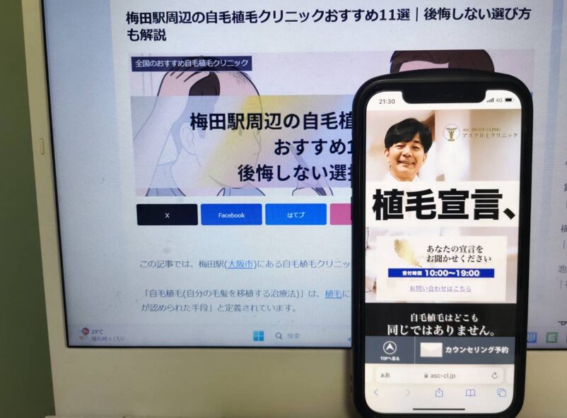 梅田駅周辺の自毛植毛クリニックおすすめ11選｜後悔しない選び方も解説