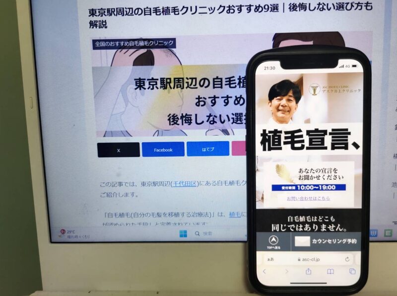 東京駅周辺の自毛植毛クリニックおすすめ9選｜後悔しない選び方も解説