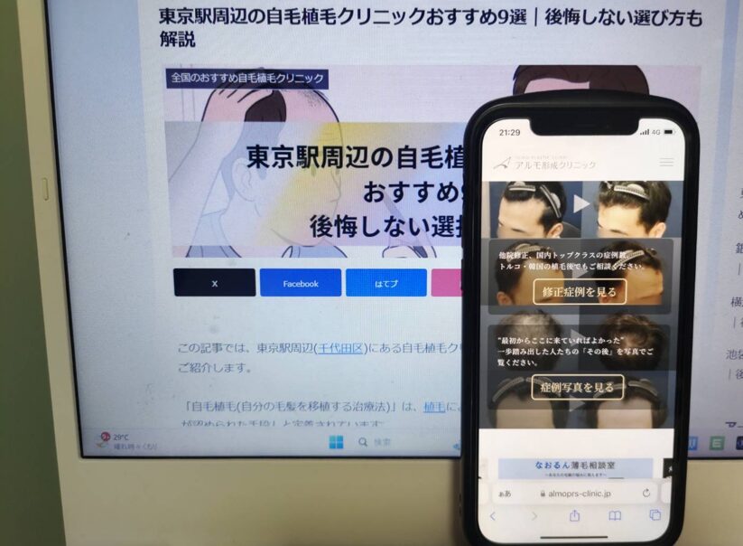 東京駅周辺の自毛植毛クリニックおすすめ9選｜後悔しない選び方も解説