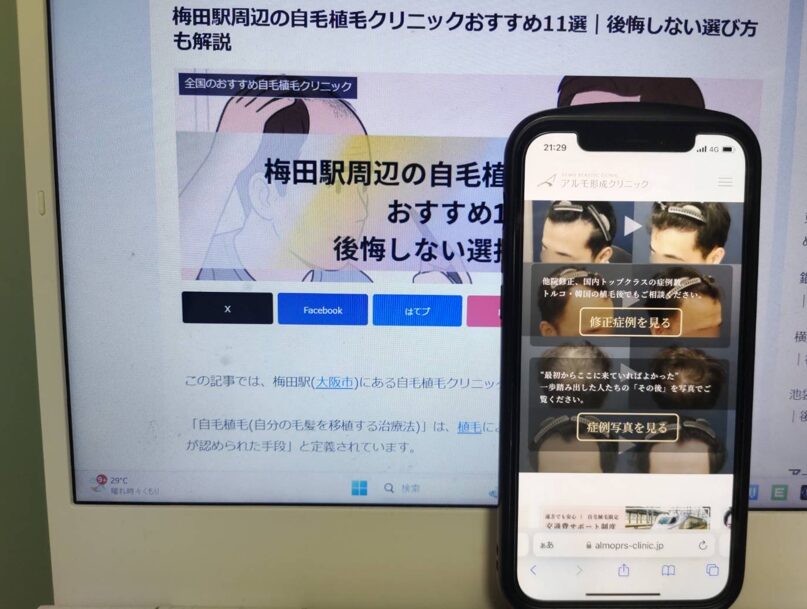 梅田駅周辺の自毛植毛クリニックおすすめ11選｜後悔しない選び方も解説