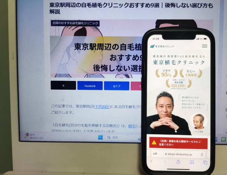 東京駅周辺の自毛植毛クリニックおすすめ9選｜後悔しない選び方も解説