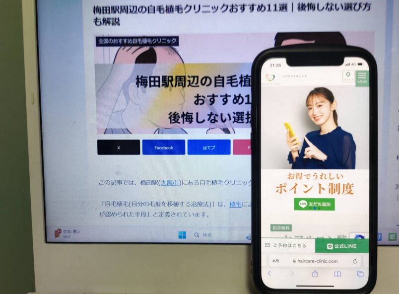 梅田駅周辺の自毛植毛クリニックおすすめ11選｜後悔しない選び方も解説