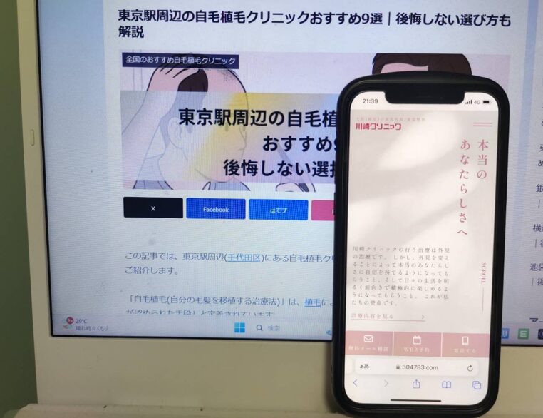梅田駅周辺の自毛植毛クリニックおすすめ11選｜後悔しない選び方も解説