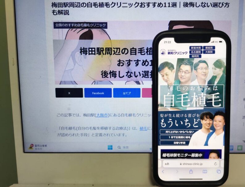 梅田駅周辺の自毛植毛クリニックおすすめ11選｜後悔しない選び方も解説