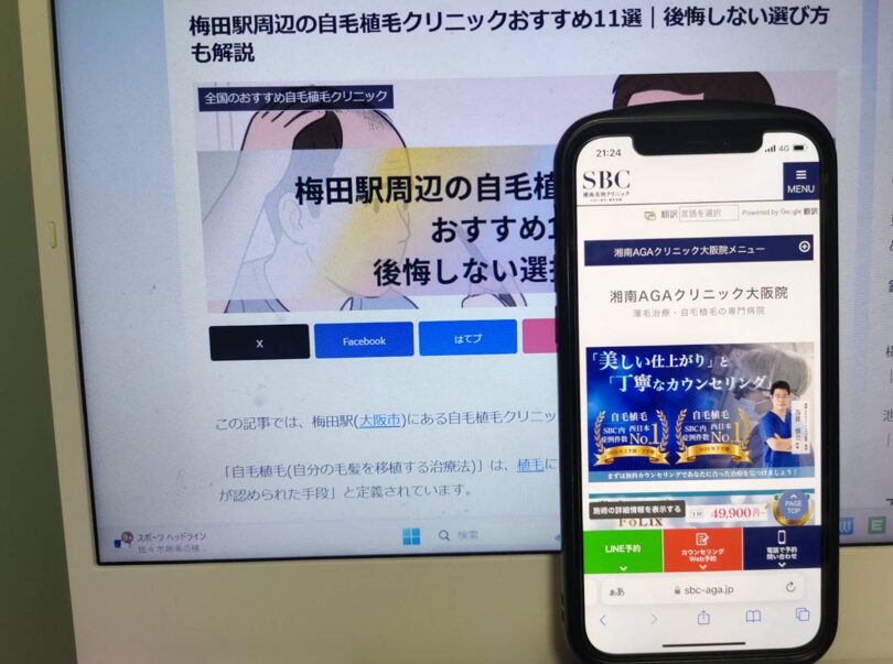 梅田駅周辺の自毛植毛クリニックおすすめ11選｜後悔しない選び方も解説