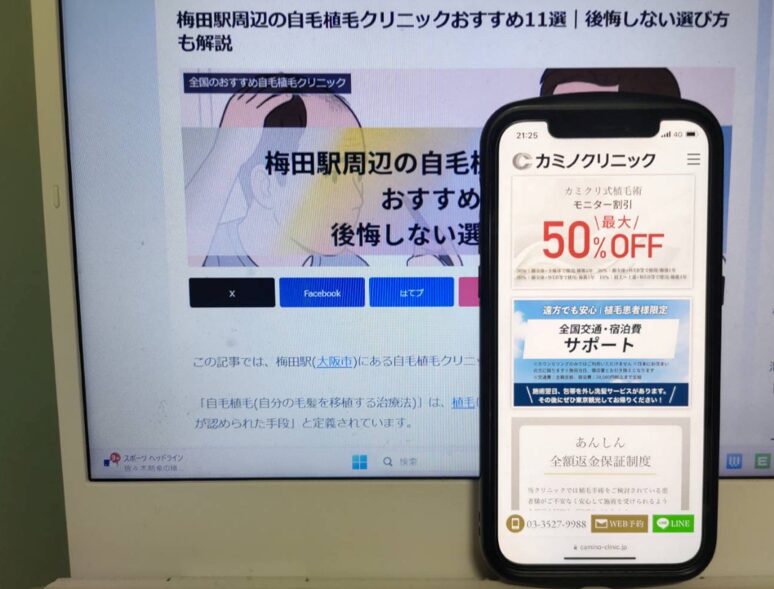 梅田駅周辺の自毛植毛クリニックおすすめ11選｜後悔しない選び方も解説