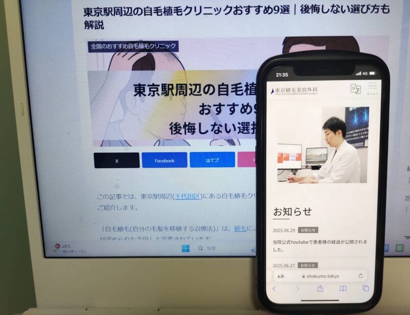 東京駅周辺の自毛植毛クリニックおすすめ9選｜後悔しない選び方も解説