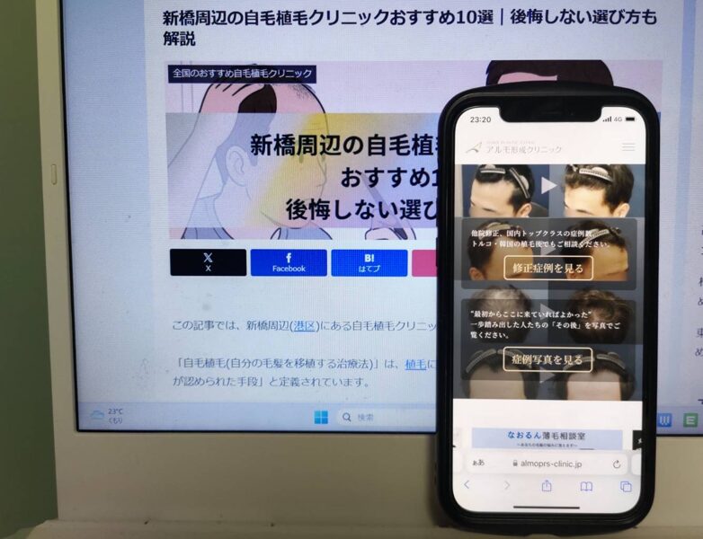 新橋周辺の自毛植毛クリニックおすすめ10選｜後悔しない選び方も解説