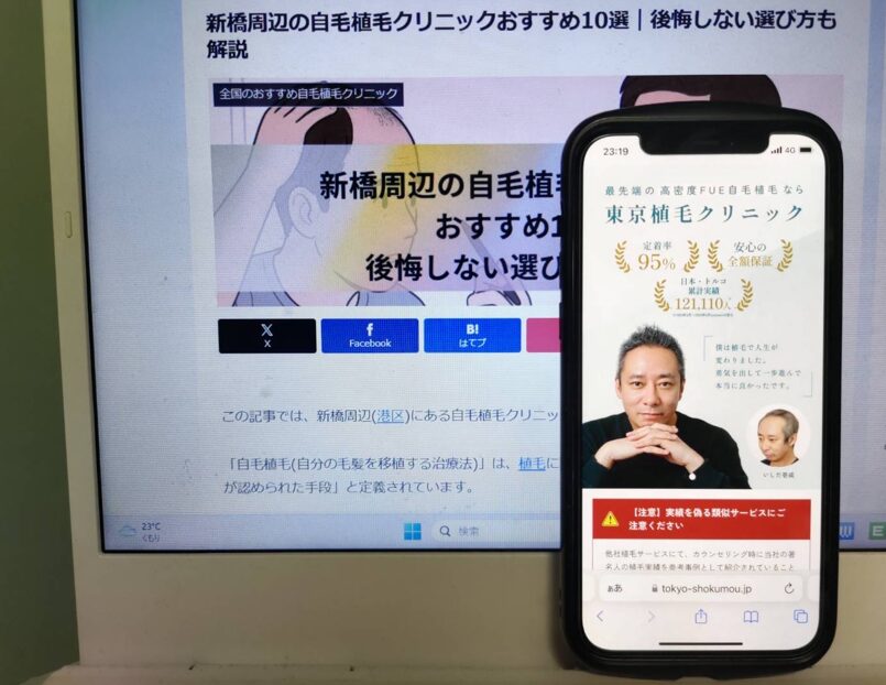 新橋周辺の自毛植毛クリニックおすすめ10選｜後悔しない選び方も解説
