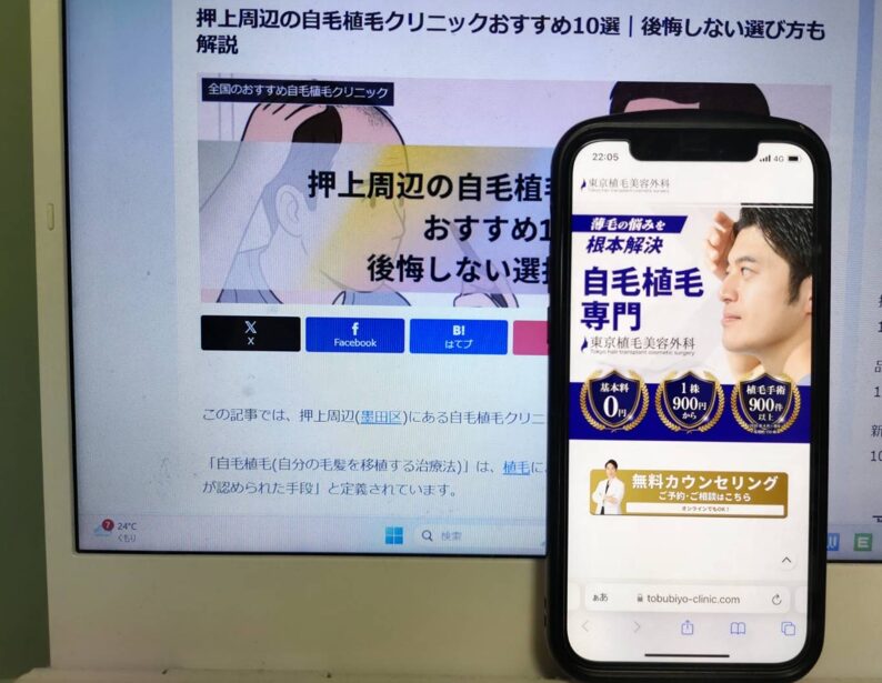押上周辺の自毛植毛クリニックおすすめ10選｜後悔しない選び方も解説
