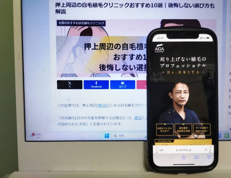押上周辺の自毛植毛クリニックおすすめ10選｜後悔しない選び方も解説
