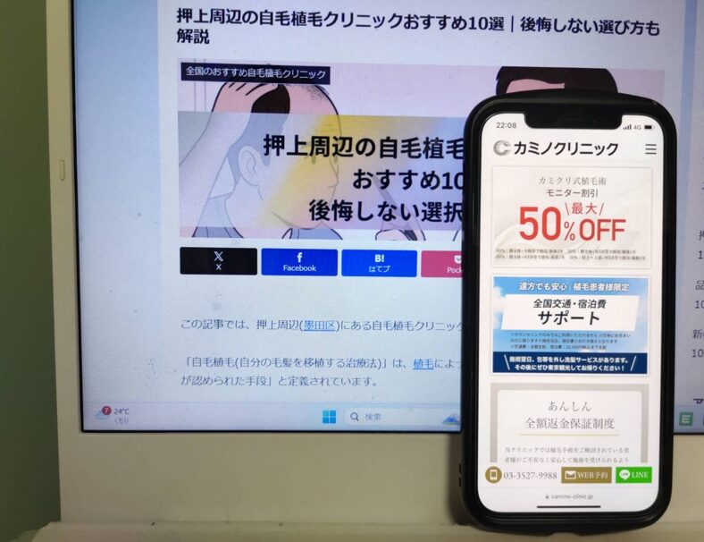 押上周辺の自毛植毛クリニックおすすめ10選｜後悔しない選び方も解説