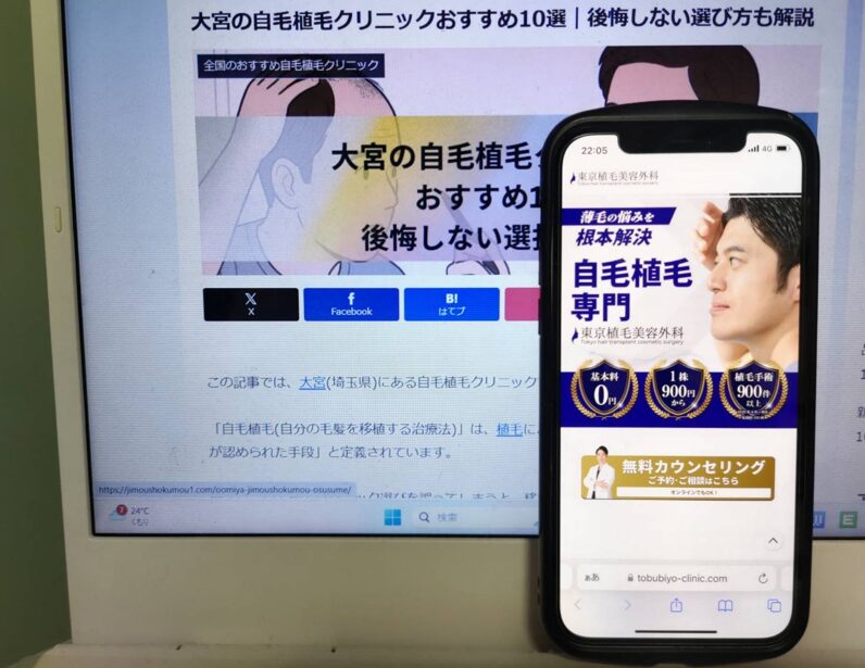 大宮の自毛植毛クリニックおすすめ10選｜後悔しない選び方も解説