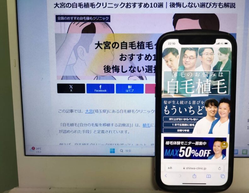 大宮の自毛植毛クリニックおすすめ10選｜後悔しない選び方も解説