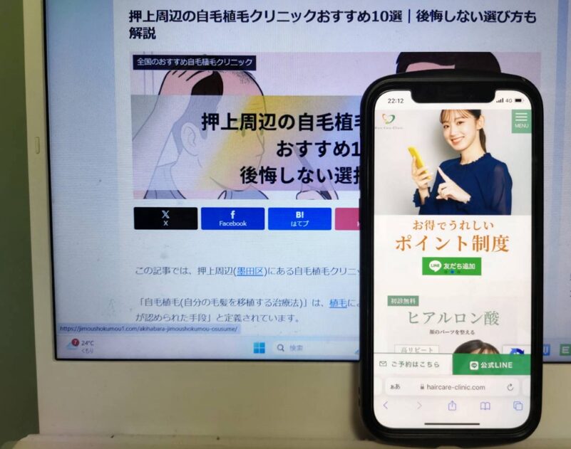 押上周辺の自毛植毛クリニックおすすめ10選｜後悔しない選び方も解説