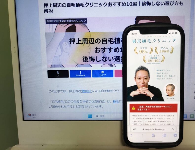 押上周辺の自毛植毛クリニックおすすめ10選｜後悔しない選び方も解説