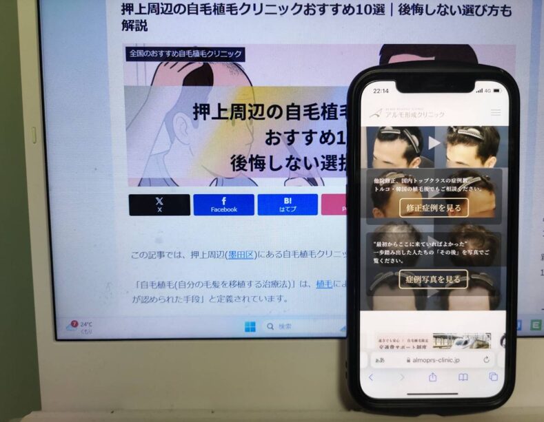 押上周辺の自毛植毛クリニックおすすめ10選｜後悔しない選び方も解説
