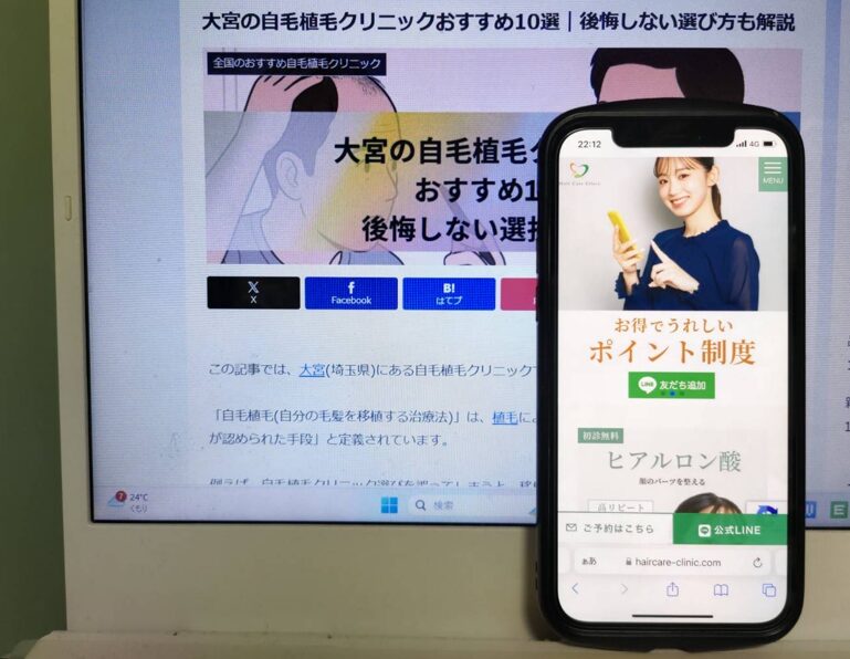 大宮の自毛植毛クリニックおすすめ10選｜後悔しない選び方も解説
