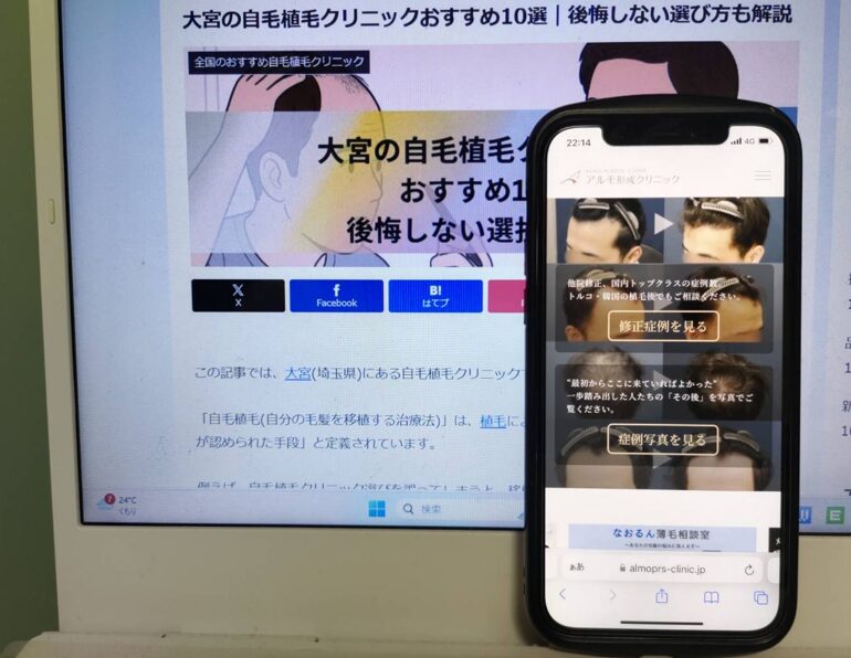 大宮の自毛植毛クリニックおすすめ10選｜後悔しない選び方も解説