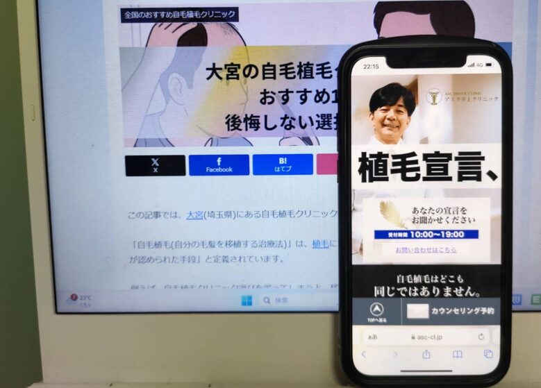 大宮の自毛植毛クリニックおすすめ10選｜後悔しない選び方も解説