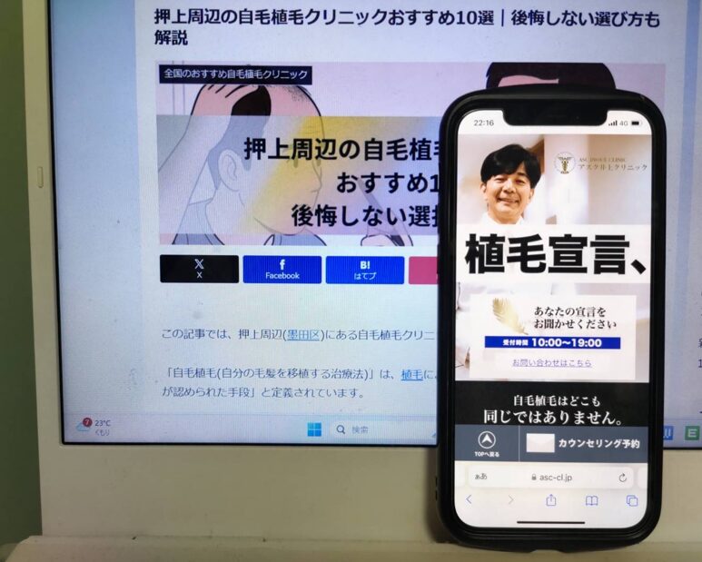 押上周辺の自毛植毛クリニックおすすめ10選｜後悔しない選び方も解説