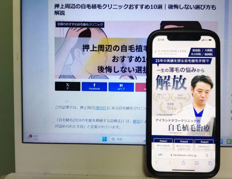 押上周辺の自毛植毛クリニックおすすめ10選｜後悔しない選び方も解説