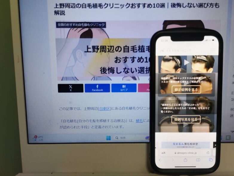 上野周辺の自毛植毛クリニックおすすめ10選｜後悔しない選び方も解説