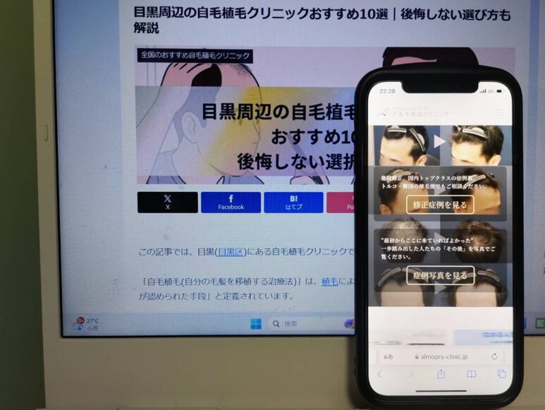 目黒周辺の自毛植毛クリニックおすすめ10選｜後悔しない選び方も解説
