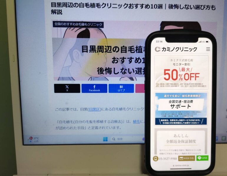 目黒周辺の自毛植毛クリニックおすすめ10選｜後悔しない選び方も解説