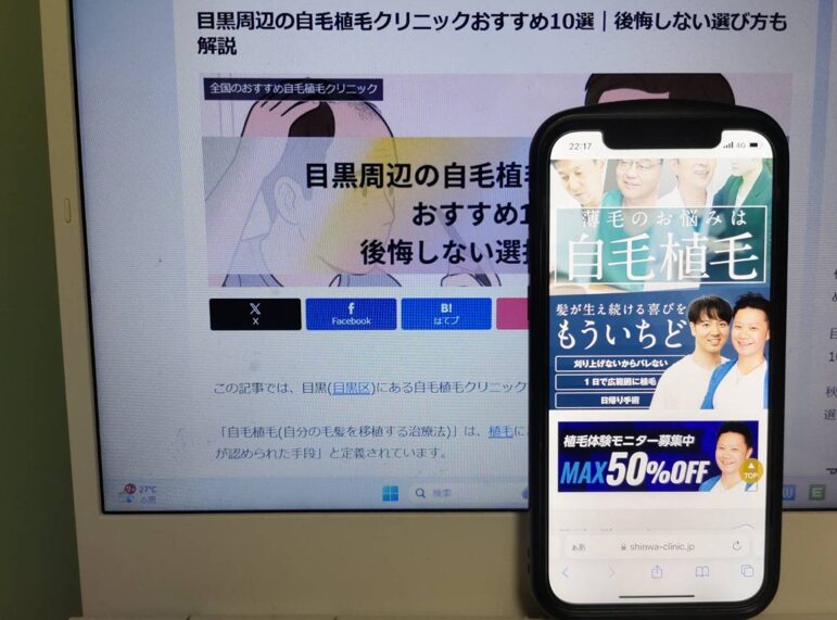 目黒周辺の自毛植毛クリニックおすすめ10選｜後悔しない選び方も解説