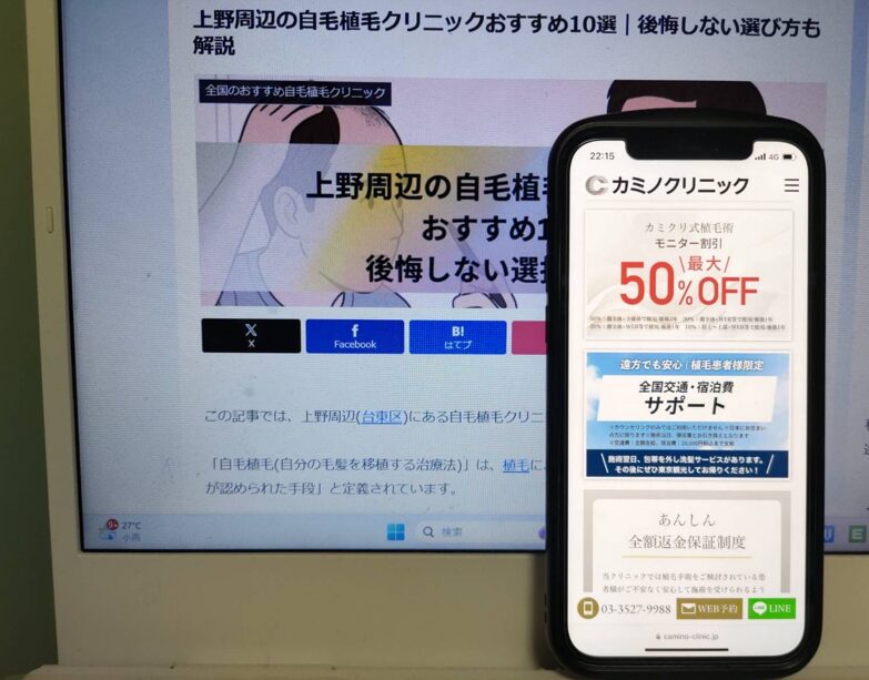 上野周辺の自毛植毛クリニックおすすめ10選｜後悔しない選び方も解説