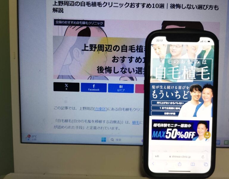 上野周辺の自毛植毛クリニックおすすめ10選｜後悔しない選び方も解説