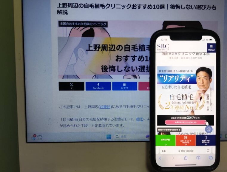 上野周辺の自毛植毛クリニックおすすめ10選｜後悔しない選び方も解説