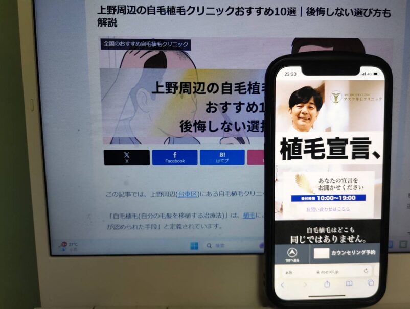 上野周辺の自毛植毛クリニックおすすめ10選｜後悔しない選び方も解説
