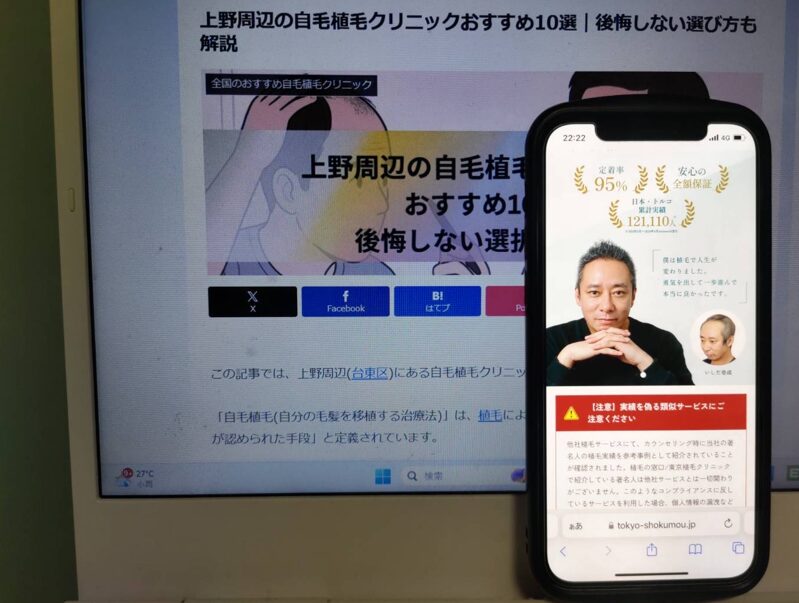 上野周辺の自毛植毛クリニックおすすめ10選｜後悔しない選び方も解説