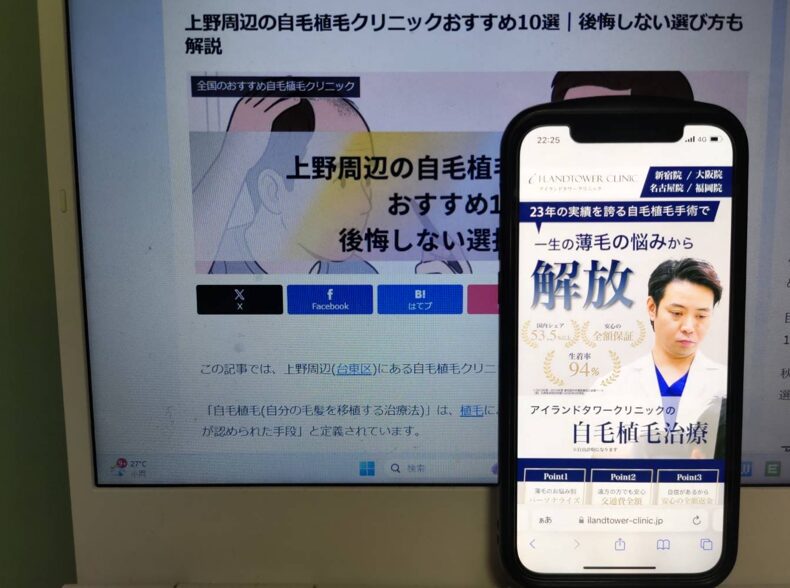 上野周辺の自毛植毛クリニックおすすめ10選｜後悔しない選び方も解説