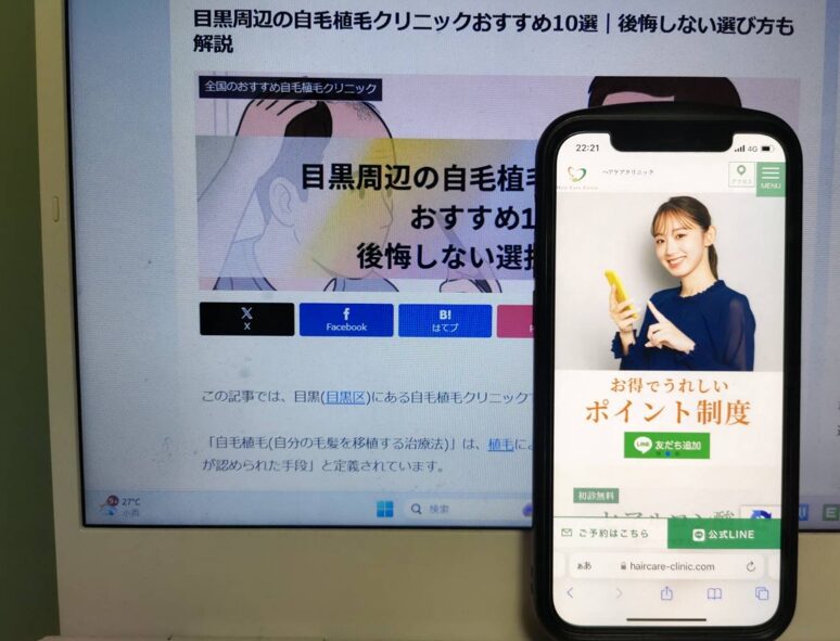 目黒周辺の自毛植毛クリニックおすすめ10選｜後悔しない選び方も解説